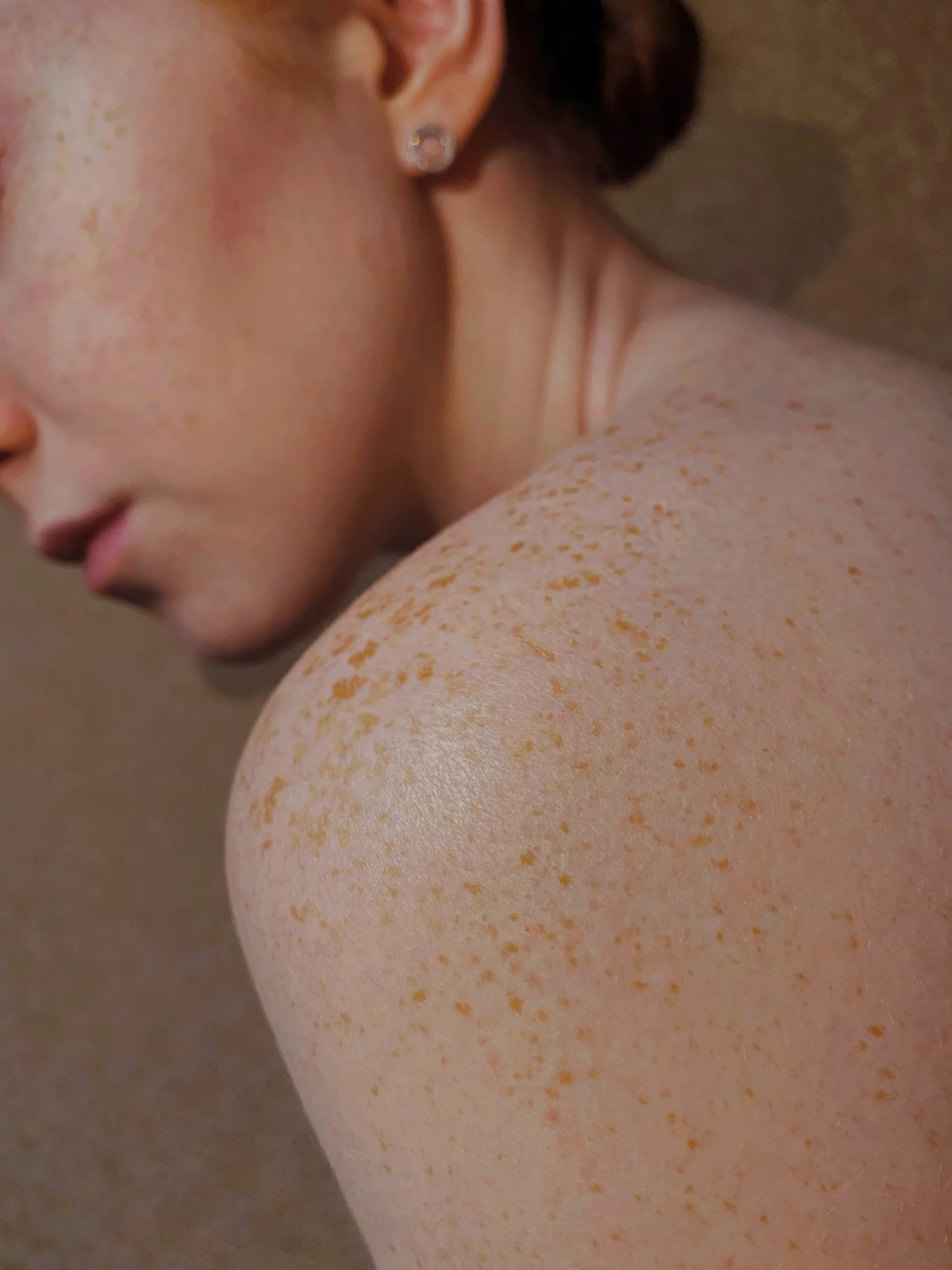 Close-up on a woman's shoulder showing natural, healthy skin, representing the Vioravia promise of wellness.